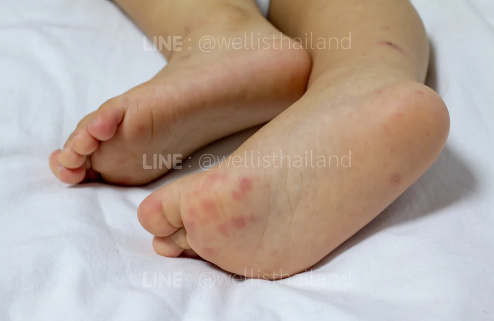 ลูกติดเชื้อได้อย่างไร_ ช่องทางการแพร่กระจายเชื้อที่ต้องป้องกัน