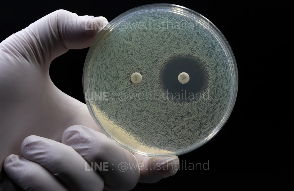 รู้จักเชื้อดื้อยา (Antimicrobial Resistance) คืออะไร